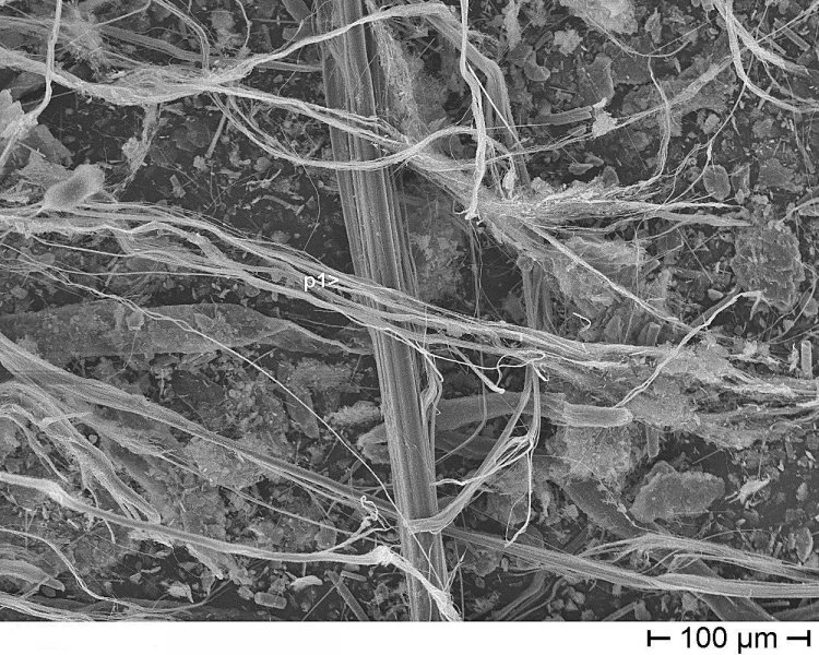 REM-EDX-Aufnahme von Weißasbest (Chrysotil) | Quelle:  Labor Dr. Schäffner GmbH